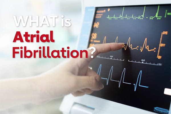 What is Atrial Fibrillation? video screenshot